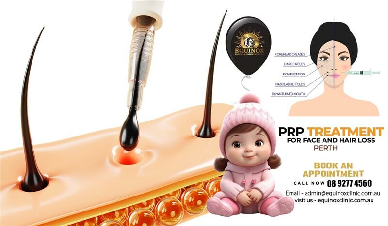 PRP treatment for face and hair loss Perth