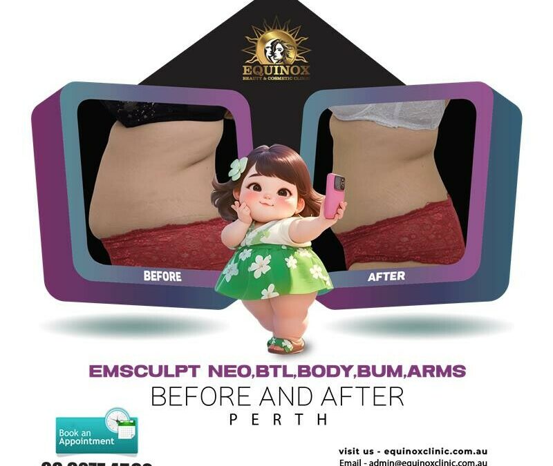 Sculpt Your Dream Body with Emsculpt Neo, BTL, Body, Bum & Arms Treatment