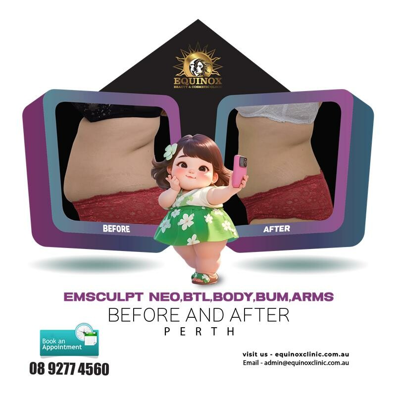 Blogs 6 Sculpt Your Dream Body with Emsculpt Neo, BTL, Body, Bum & Arms Treatment