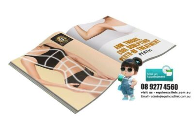 Reveal Your Best Shape with Sculpting and RF Treatment