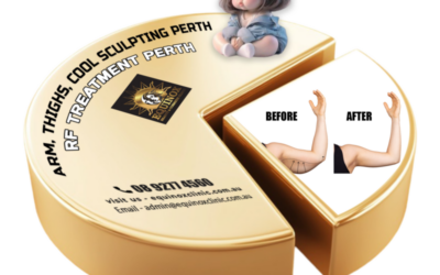 Beauty Enhancement Treatments: Cool Sculpting, RF Treatments & Non-Surgical Lifts