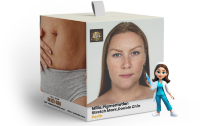 Milia, Pigmentation, Stretch Mark and Double Chin Removal: Awaiting New Transformations