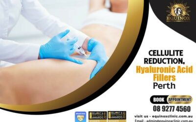 Insights into Non-Surgical Cellulite Reduction in Perth