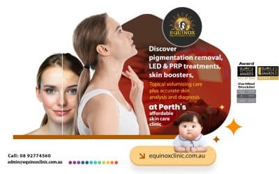 Pigmentation Removal : Understanding Causes, Treatment Options and Skin Care in Perth