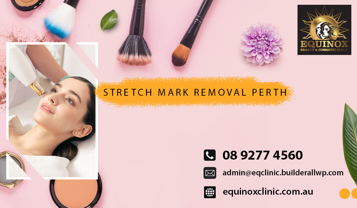 Stretch Mark Removal Perth