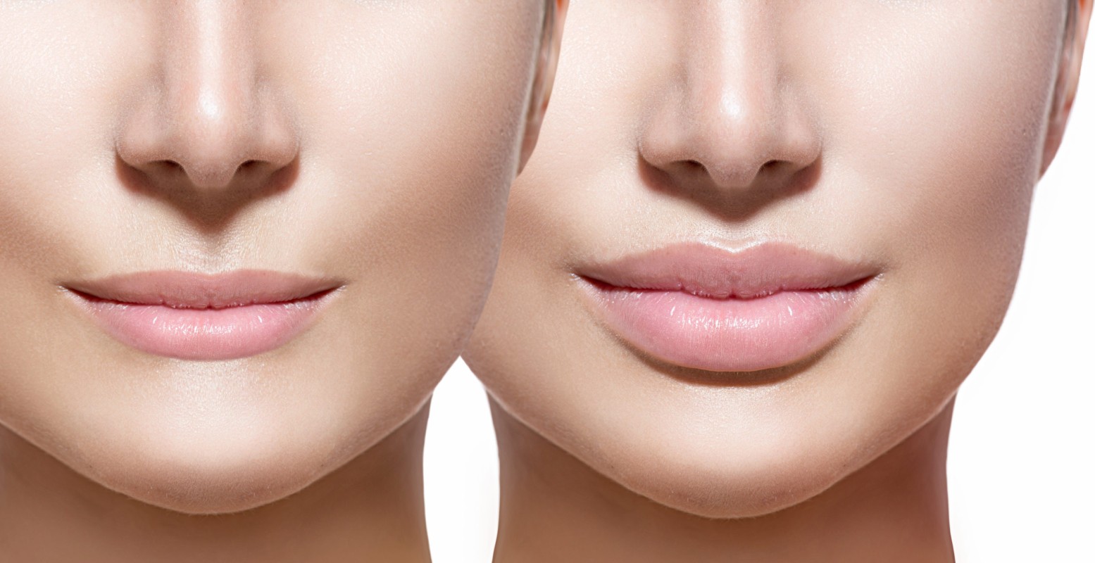 Non-surgical lift & skin tightening for the jawline, jowls, neck and brow