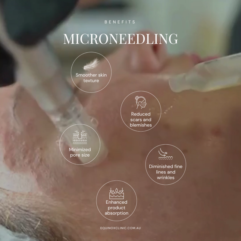 Non-surgical lift & skin tightening for the jawline, jowls, neck and brow