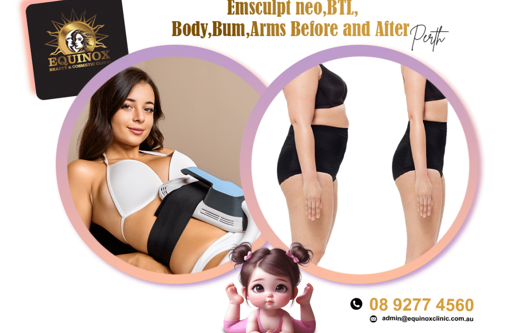 Emsculpt Neo BTL body bum arms Perth