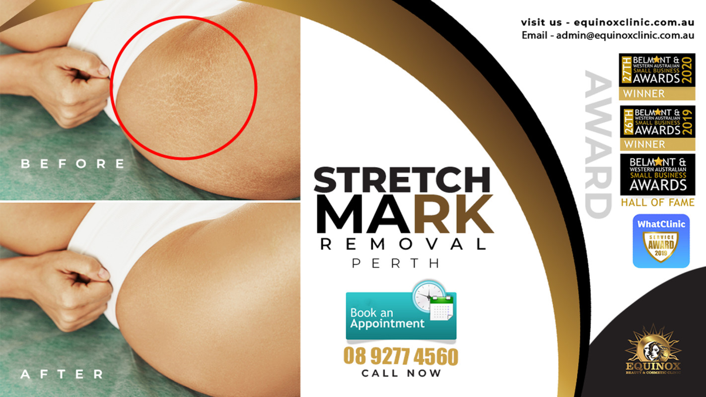 Blogs 2 An In-depth Knowledge on Stretch Mark Removal Treatments