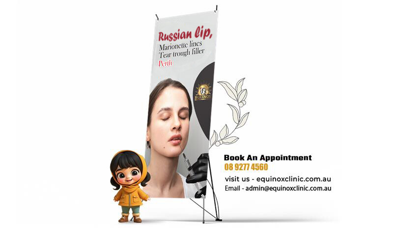 Rejuvenate, Define and Shine with Dermal, Russian Lip, Marionette Lines & Tear Trough Filler