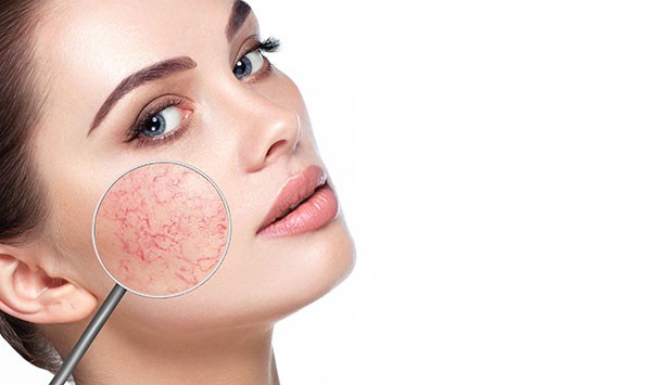 Laser Skin Rejuvenation